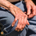 Parkinson Tudástár - Diagnózistól a műtétig